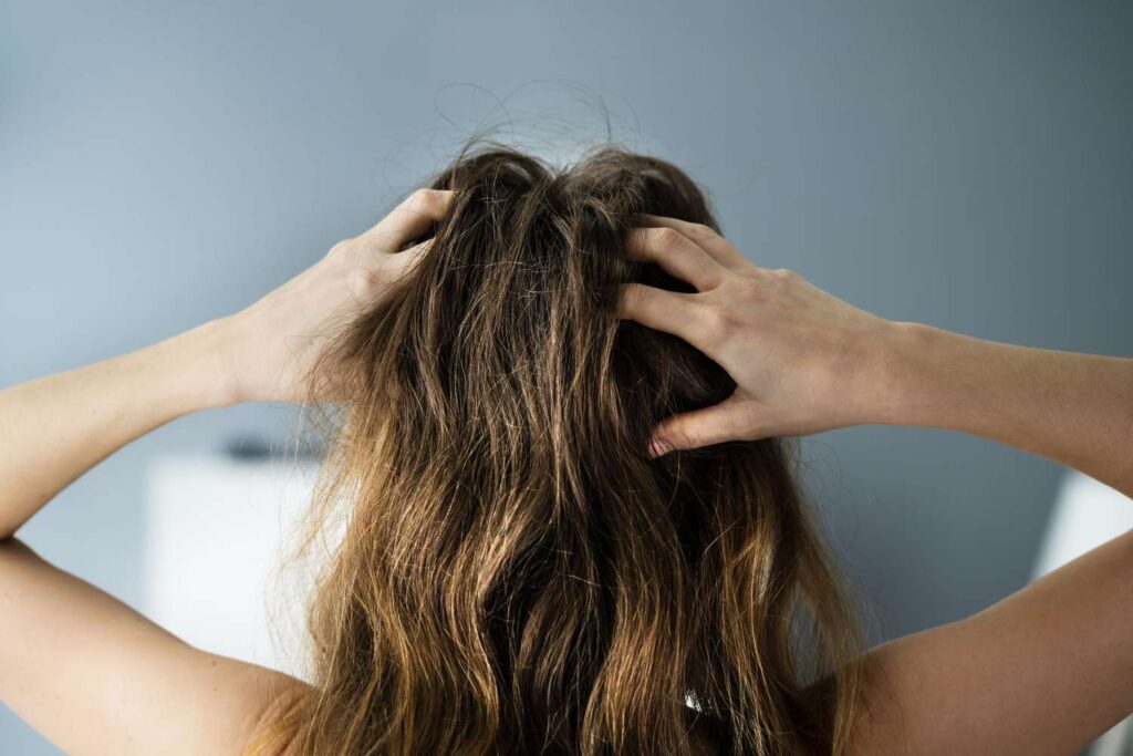 thinning-hair-in-women