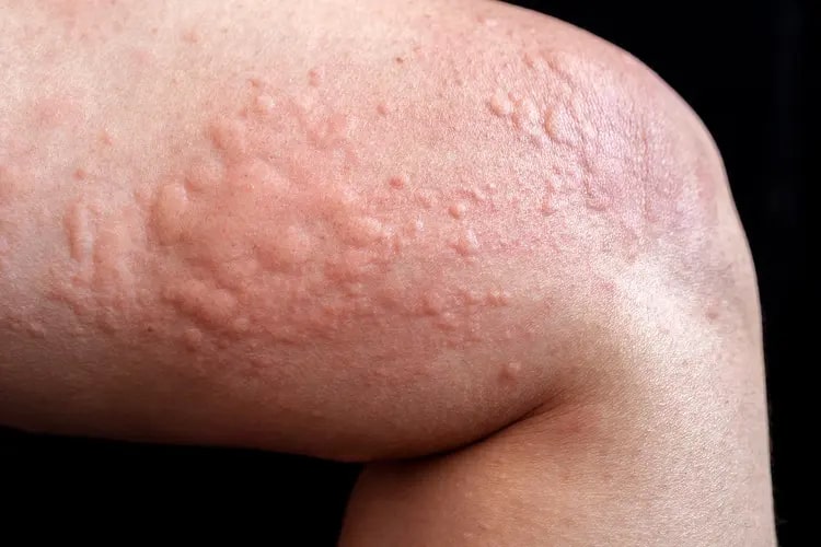 hair-removal-creams-2025